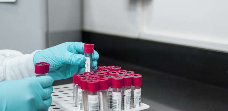 Advanced Diagnostics: Breaking Down Results