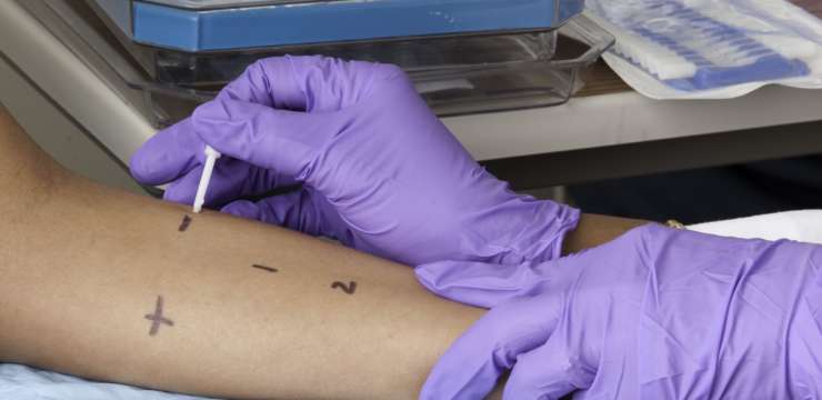 Testing For Immunoligical Reactions | El Paso Texas Chiropractor