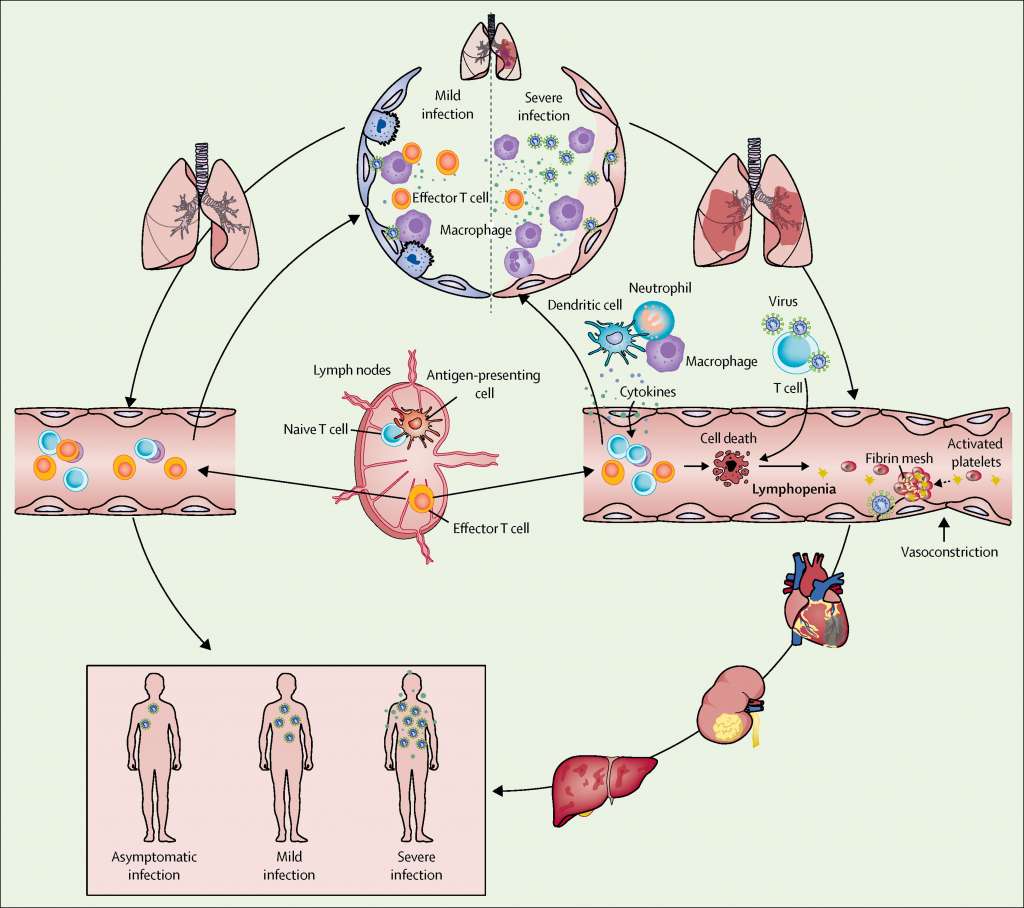 cytokine storm