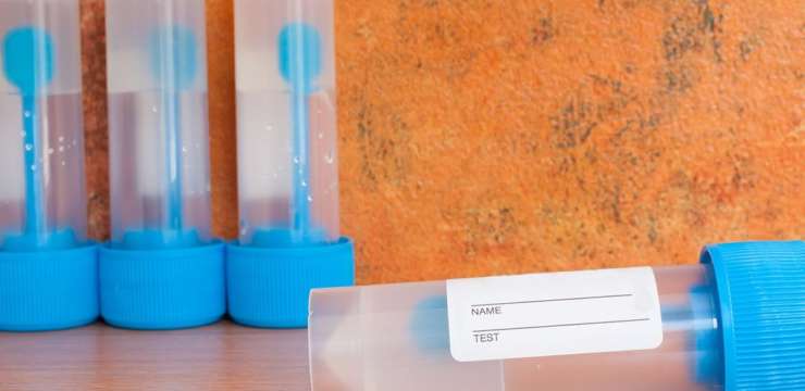 The Importance of Lab Testing| El Paso Texas Chiropractor