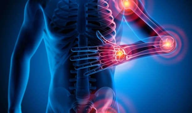 Arthritis in El Paso TX